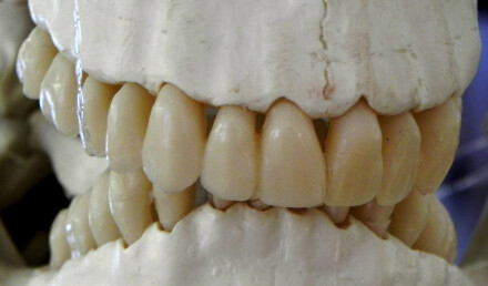 Toothline, Teresa Beetham
